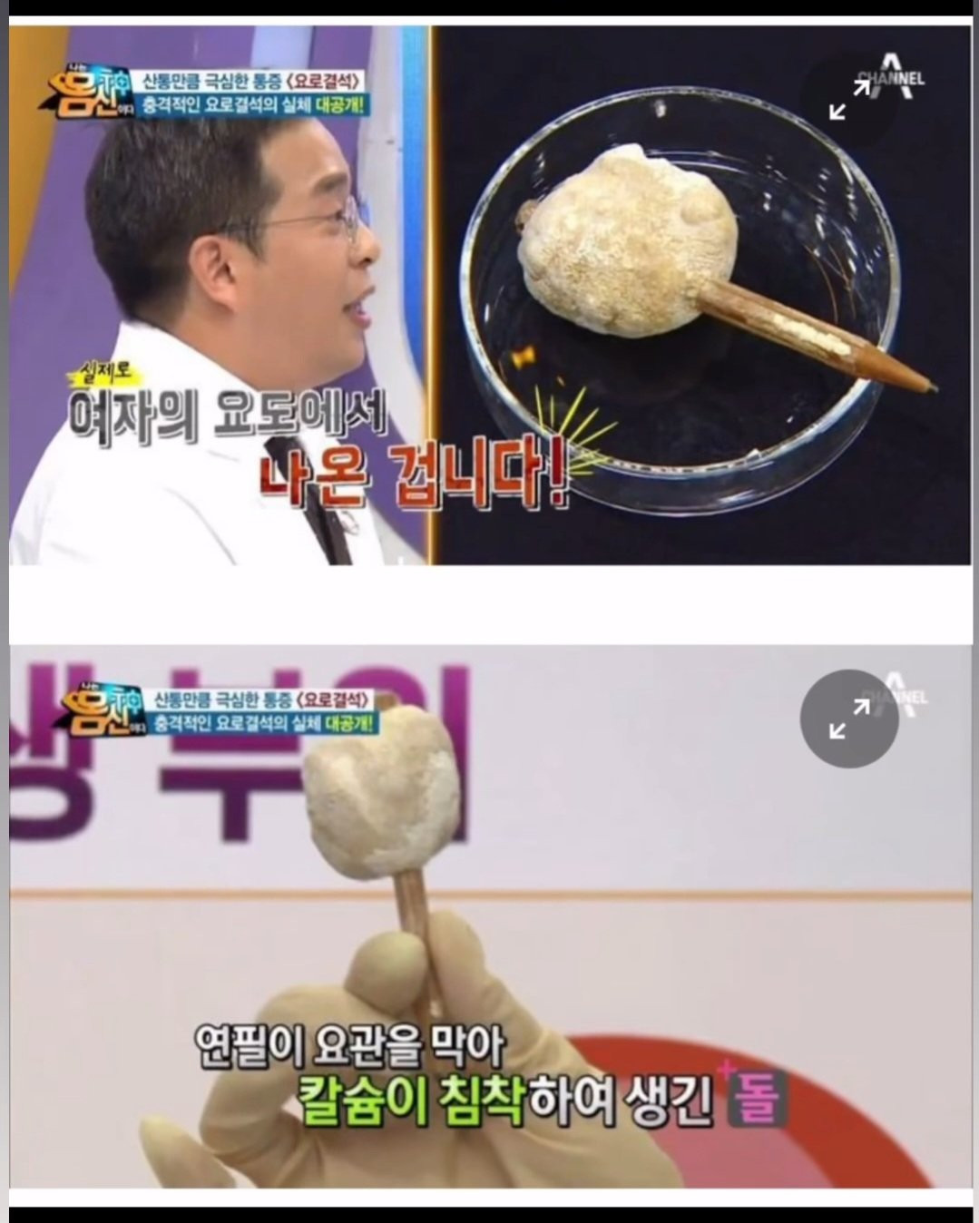 요로결석에 걸린이유