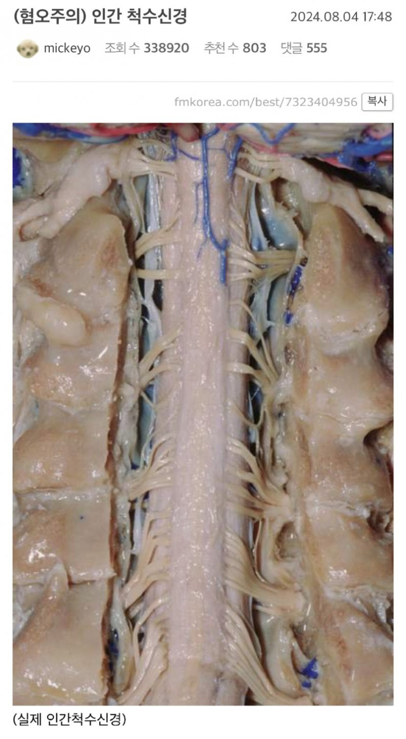 약혐주의 실제 인간의 척수신경.jpg