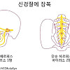 헤르페스가 완치가 불가능한 이유
